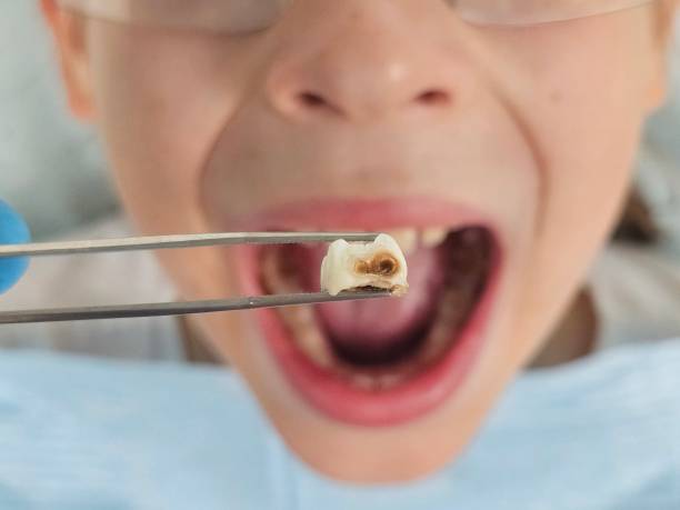 Best Emergency Care for Gum Disease in Moodys, OK